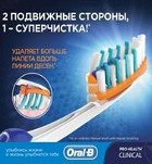 Индивидуальный подход к чистке зубов
